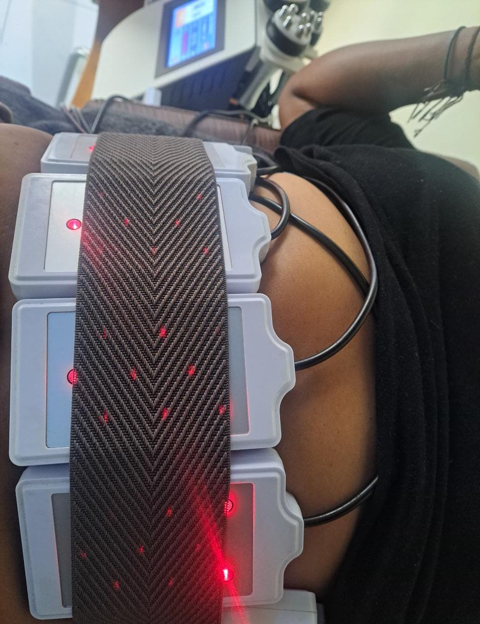 Fat freeze treatment at The Body Fix