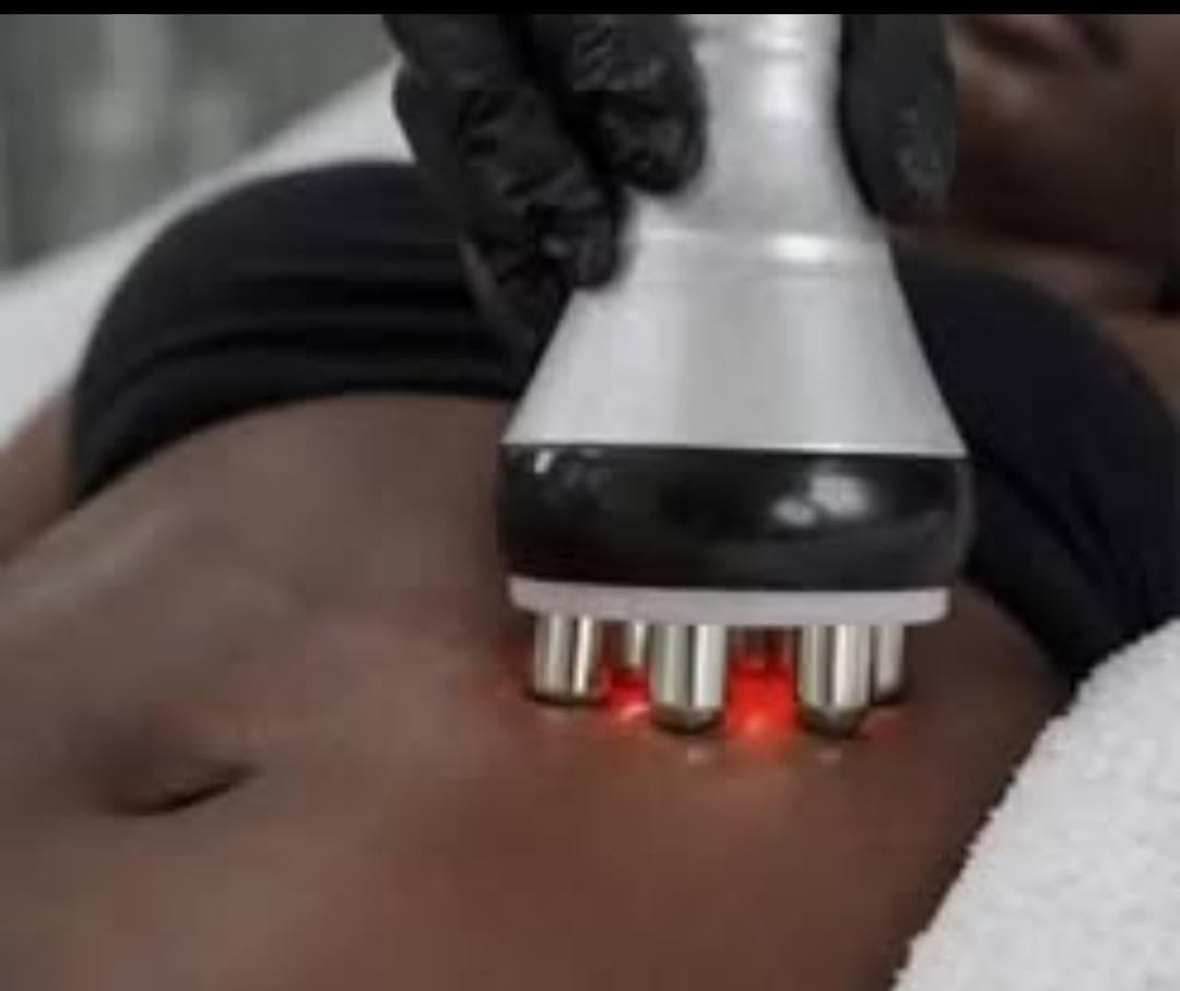 Lipo cavitation treatment at The Body Fix